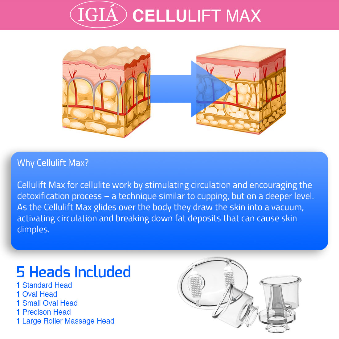 Cellulift Max Cellulite Reducing Suction Vacuum Massager IGIA NEW YORK